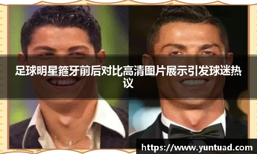 足球明星箍牙前后对比高清图片展示引发球迷热议